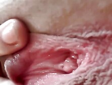 Freckle on my butthole