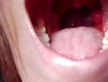 I accidently eat my ally [Trailer] [Dm to buy the full Ver. ]