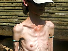 Anorexic Denisa 8T00656 10-08-2020