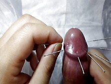 Cbt Needling Penis