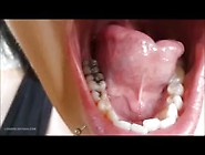 Pretty Woman With Lovely Cupped Cleft Tongue-Pt.  1