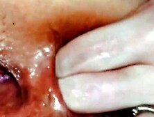 HUBBY AND WIFES TOYING BUSHY ASSHOLE