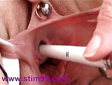 Cervix And Peehole Fucking With Objects Masturbating Urethra