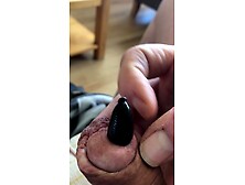 Leech in cock