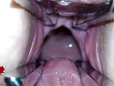 The Mistress Cunt Is Opened With A Hole Expander So That You Can Study Her Cervix