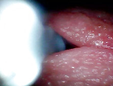 Endoscope camera captures moment of male ejaculation