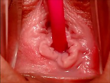 Inside The Vagina Collection