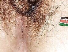 Nairobi anus