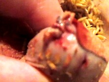 Maggots fighting to get deeper into damaged head