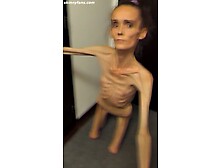 anorexic Denisa 8t00975 24-11-2025