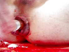 Speculum And Bleeding Pussy