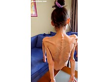 anorexic Denisa 8t00957 27-07-2025
