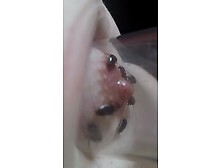 Cucarachas en mi pezon