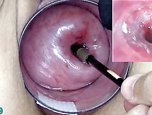Cougar Milf Cervix Play with Endoscope Oriental Web-cam into Uterus