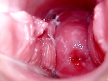 Cervix Display and Speculum Play