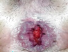 Closeup anal gaping with a bottle