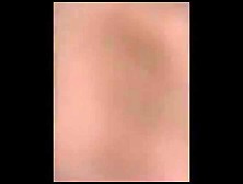 Hidden cam at medical