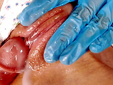 Pervert Doctor Slaps Vagina and Fingers Teeny