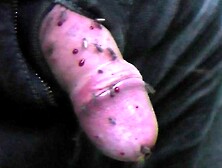 Mosquitoes and drops of blood by biting flies