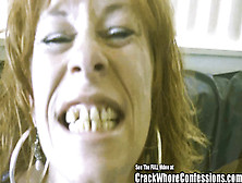 Donkey Teeth Red Head Mom Crack Slut