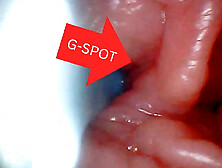 First Time: an Endoscope Reveals the G-spot up Close - Without Mounting!