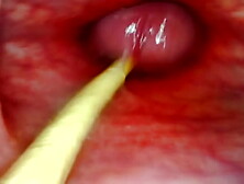 EXTREME ANAL SELF PERSPECTIVE.  WEBCAM INSIDE HER BUTT-HOLE AS I POUND HER WITH MY MONSTROUS PENIS AND SPERM DEEP INSIDE