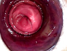 Extreme pussy stretching with thick plastic sylinder