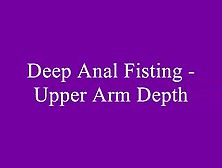 Youporn - Meet Her On Bondage Dom Com Deep Anal Fisting Upper Ar