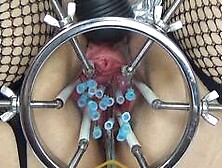 Extreme German Bdsm Needles Inner Pussy Cervix And Tits