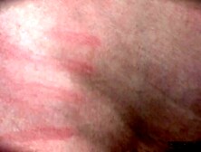 Blackmail backfigres