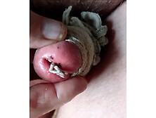 Gland fourru00e9 aux asticots.