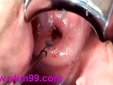 Cervix Fucking Play Deep Asian Japanese - å­å®®é ¸éƒ¨ã‚¯ã‚½