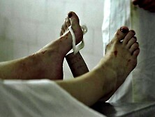 Dead Russian Barefeet Hooker In Morgue