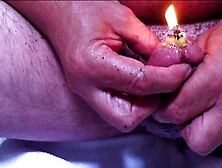 Penis Burned With A Candle In The Urethra