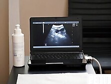 Tiny Twink Assfingered On Ultra Sound By Doctor In Infirmary