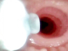 A detailed examination of Lopuza93 oral cavity and anal area using an endoscope camera.