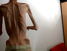 Anorexic Denisa 8T00675 28-12-2020