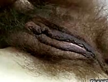 Ugly Amateur With Very Hairy Pussy Lips And Asshole
