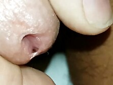 Sperm Flows Out Of The Wide Open Acorn Hole