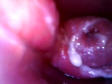 Play with Speculum and view inside my Twat by inside Webcam