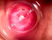 Camera Deep Inside Mia's Vagina