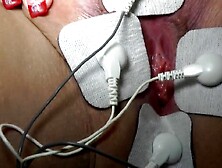 ELECTRICITY simply makes concupiscent