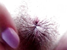 Asshole Exteme Closeup Booty Bdsm Anal