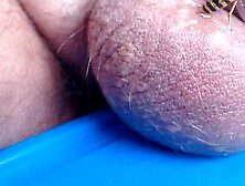 Scrotum filled up with wasp venom