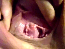 Sklavins Shows Her Destroyed Peehole After the First Pisshole Fuck by Her Master!