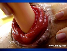 Sindy Rose Pump Her Anal Prolapse With Penis Pump & Fuck It With Shrimp Cock Dildo