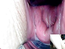 AdalynnX - Endoscope Speculum Hitachi Dildo Cum