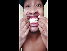 Warning! Extreme Teeth Porn (1)