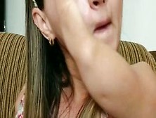 Brazilian Lady Deformed Arms