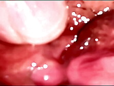Homemade Pink Twat: 158 days after losing her virginity.